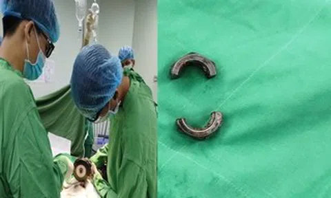 Bác sĩ tại Cần Thơ dùng máy cắt cứu người đàn ông ở An Giang gặp nạn vì “nâng cấp dương vật"