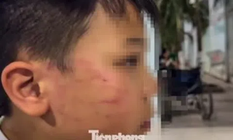 Tin mới vụ giáo viên người nước ngoài tát vào mặt học sinh